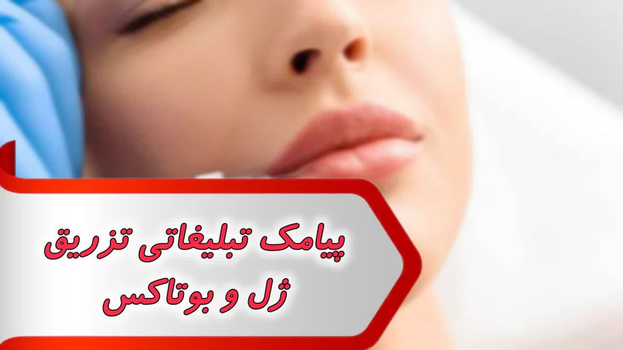 پیامک تبلیغاتی ژل و بوتاکس